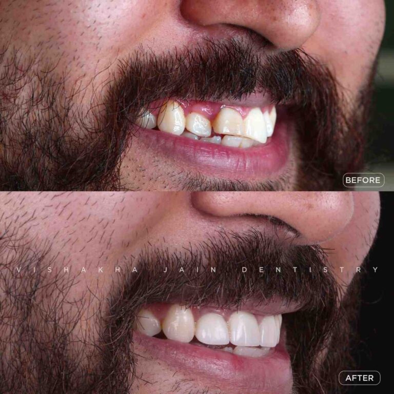 best-dental-clinic-in-indore