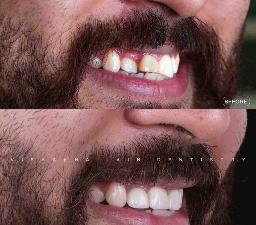 best dental clinic in indore