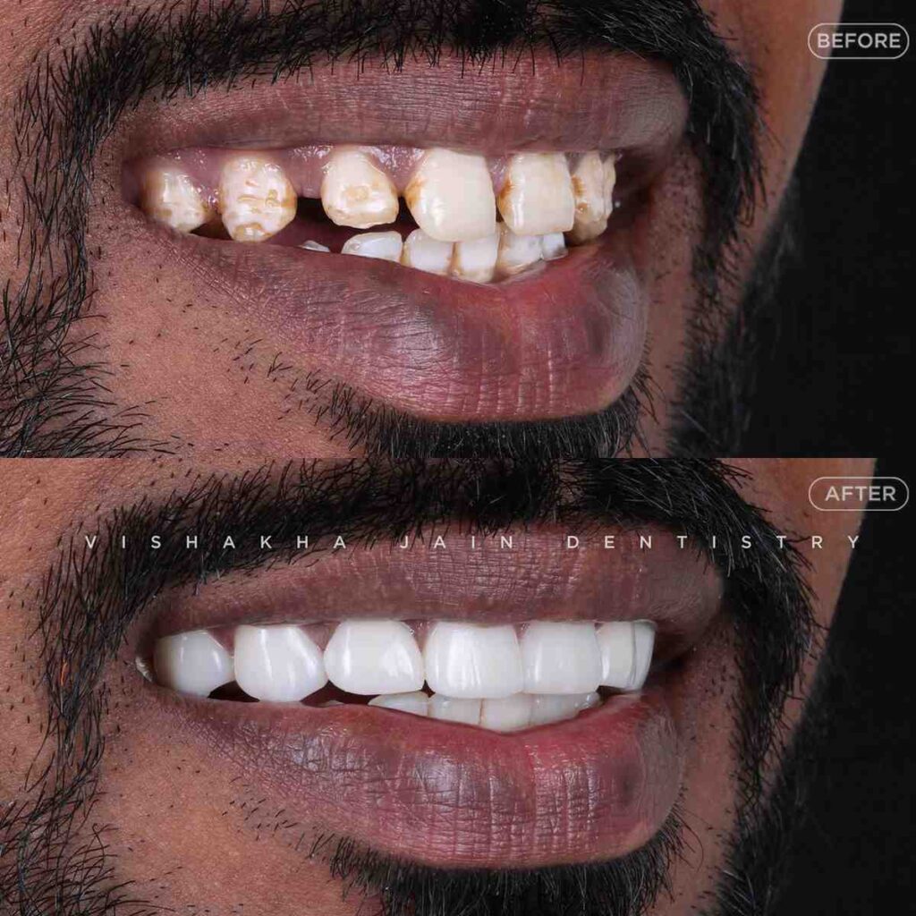 cosmetic dentist indore