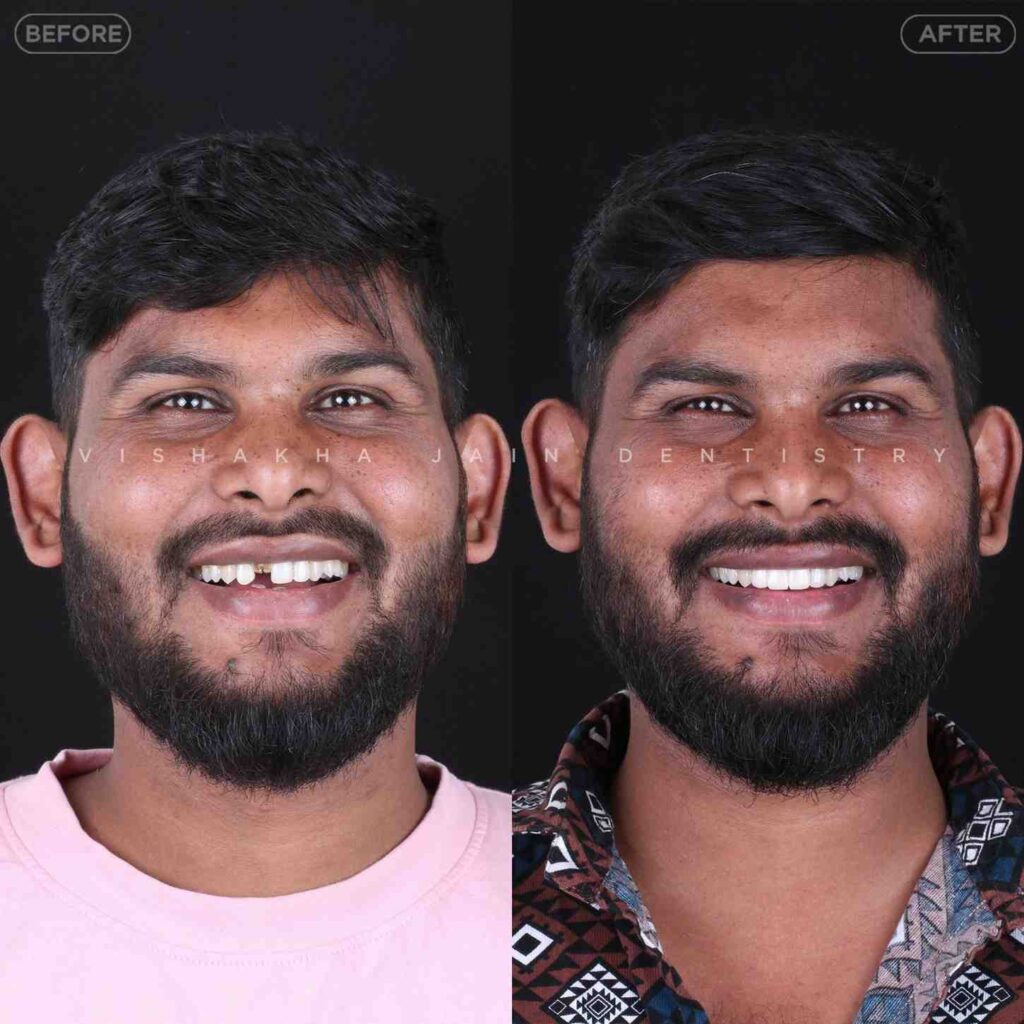 cosmetic dentist indore