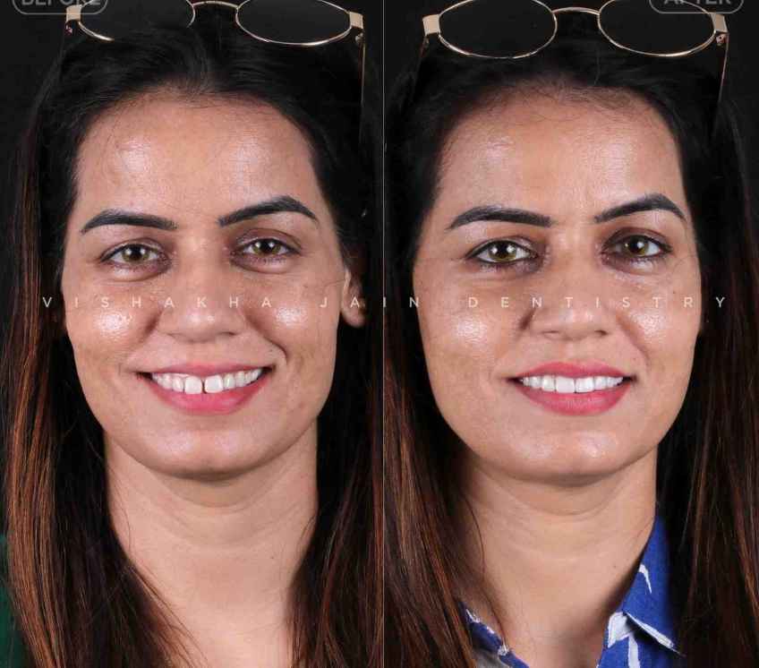 dental treatment indore