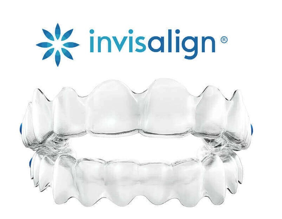 invisible-braces-treatment-indore