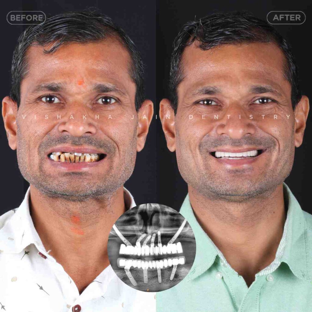 dentist near me, dental clinic near me, best dentist near me, nearby dentist, dental implants near me, teeth whitening near me, smile design near me, root canal near me, braces near me, aligners near me, cosmetic dentistry near me, gum treatment near me, pediatric dentist near me, oral care near me, affordable dentist near me