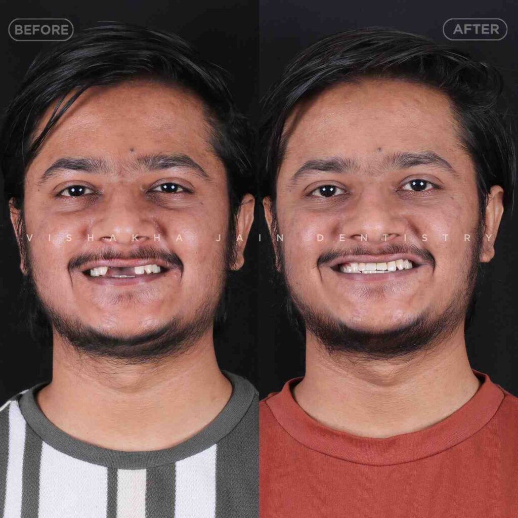 best-child-dentist-in-indore