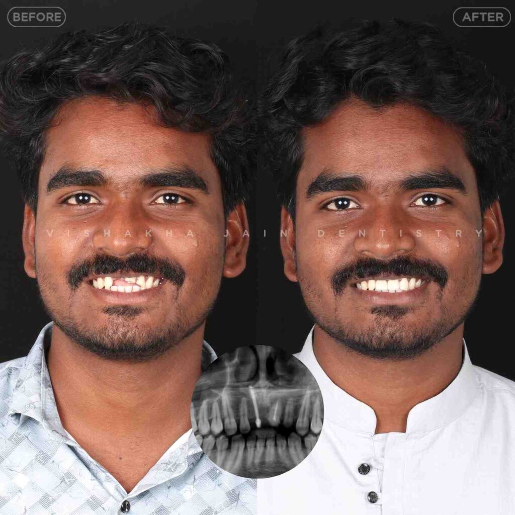 dentist near me, dental clinic near me, best dentist near me, nearby dentist, dental implants near me, teeth whitening near me, smile design near me, root canal near me, braces near me, aligners near me, cosmetic dentistry near me, gum treatment near me, pediatric dentist near me, oral care near me, affordable dentist near me