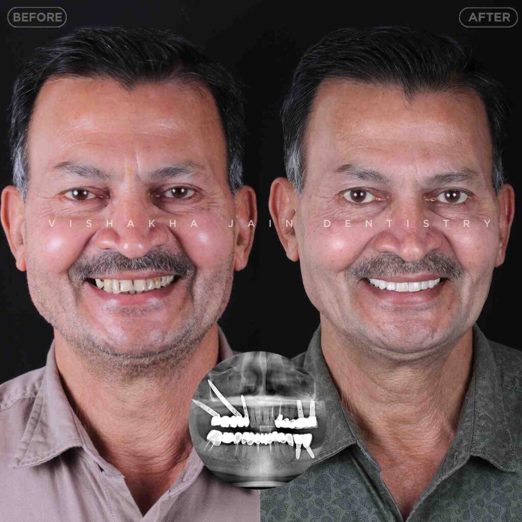 dentist near me, dental clinic near me, best dentist near me, nearby dentist, dental implants near me, teeth whitening near me, smile design near me, root canal near me, braces near me, aligners near me, cosmetic dentistry near me, gum treatment near me, pediatric dentist near me, oral care near me, affordable dentist near me