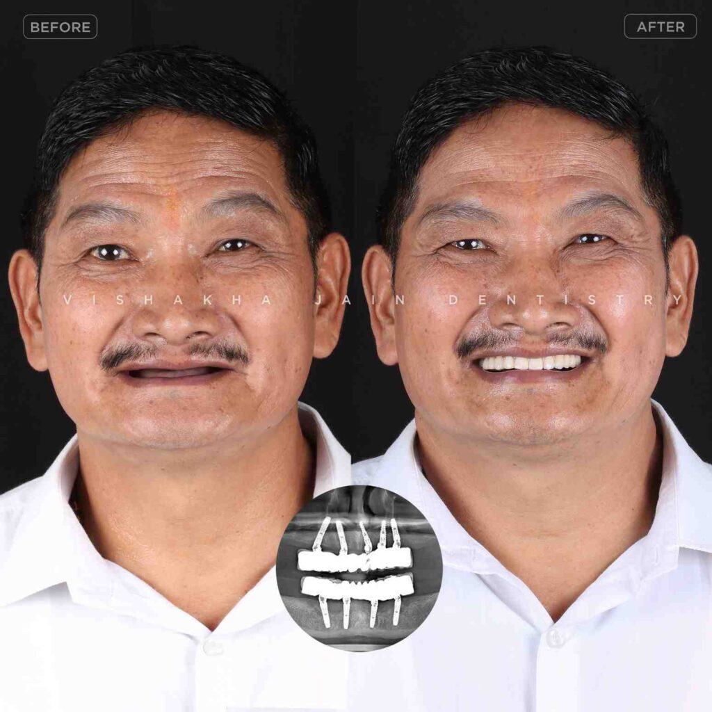 dentist near me, dental clinic near me, best dentist near me, nearby dentist, dental implants near me, teeth whitening near me, smile design near me, root canal near me, braces near me, aligners near me, cosmetic dentistry near me, gum treatment near me, pediatric dentist near me, oral care near me, affordable dentist near me
