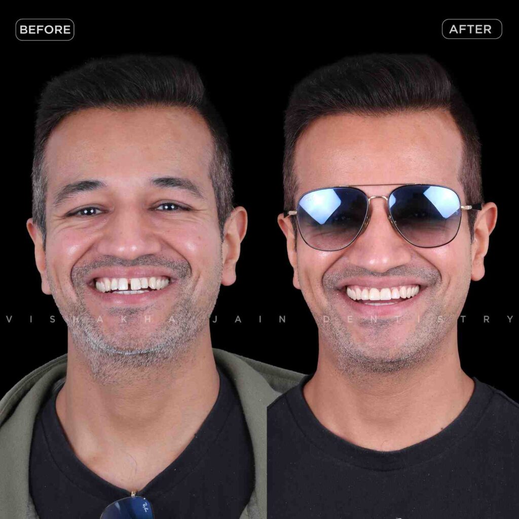 dentist near me, dental clinic near me, best dentist near me, nearby dentist, dental implants near me, teeth whitening near me, smile design near me, root canal near me, braces near me, aligners near me, cosmetic dentistry near me, gum treatment near me, pediatric dentist near me, oral care near me, affordable dentist near me