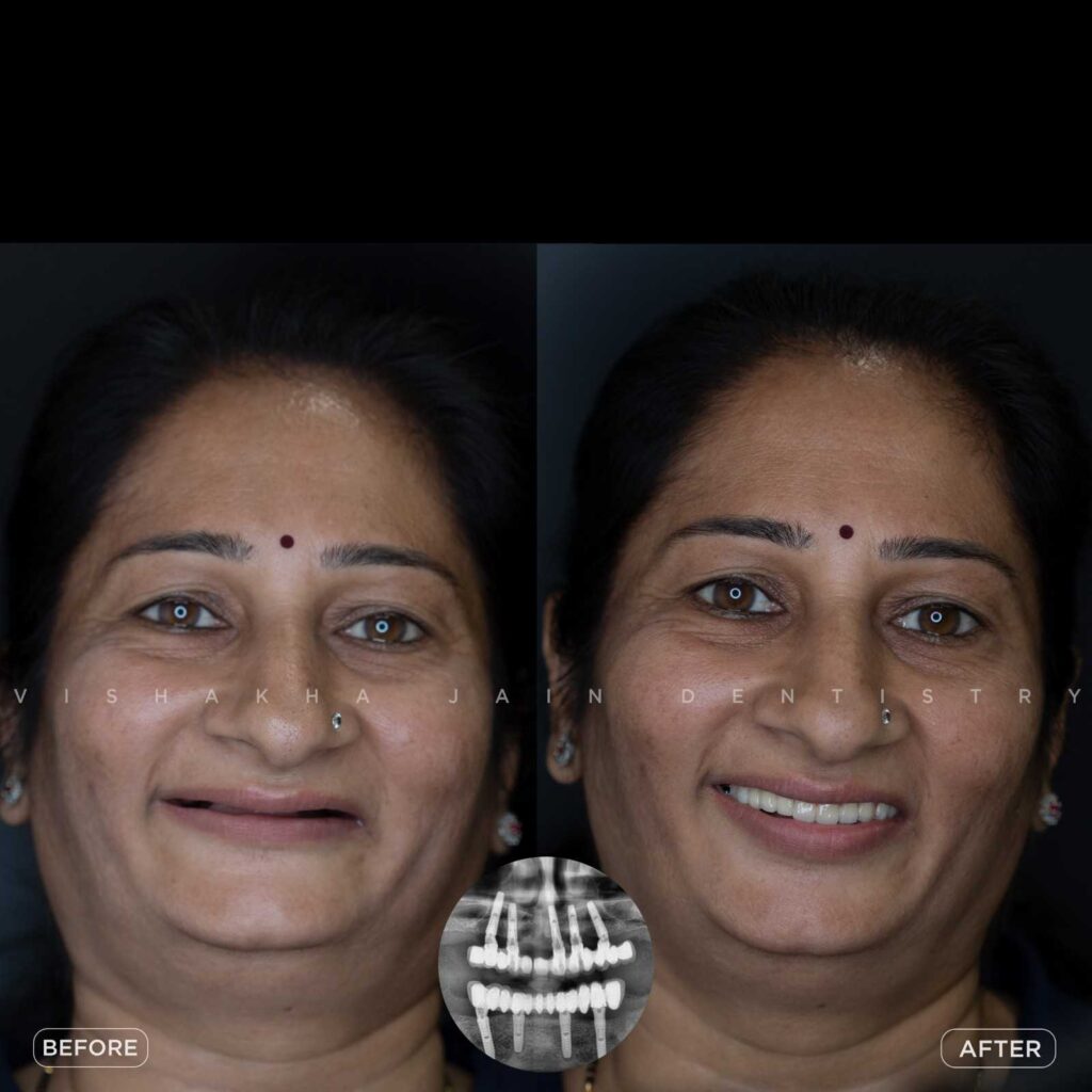 dentist near me, dental clinic near me, best dentist near me, nearby dentist, dental implants near me, teeth whitening near me, smile design near me, root canal near me, braces near me, aligners near me, cosmetic dentistry near me, gum treatment near me, pediatric dentist near me, oral care near me, affordable dentist near me