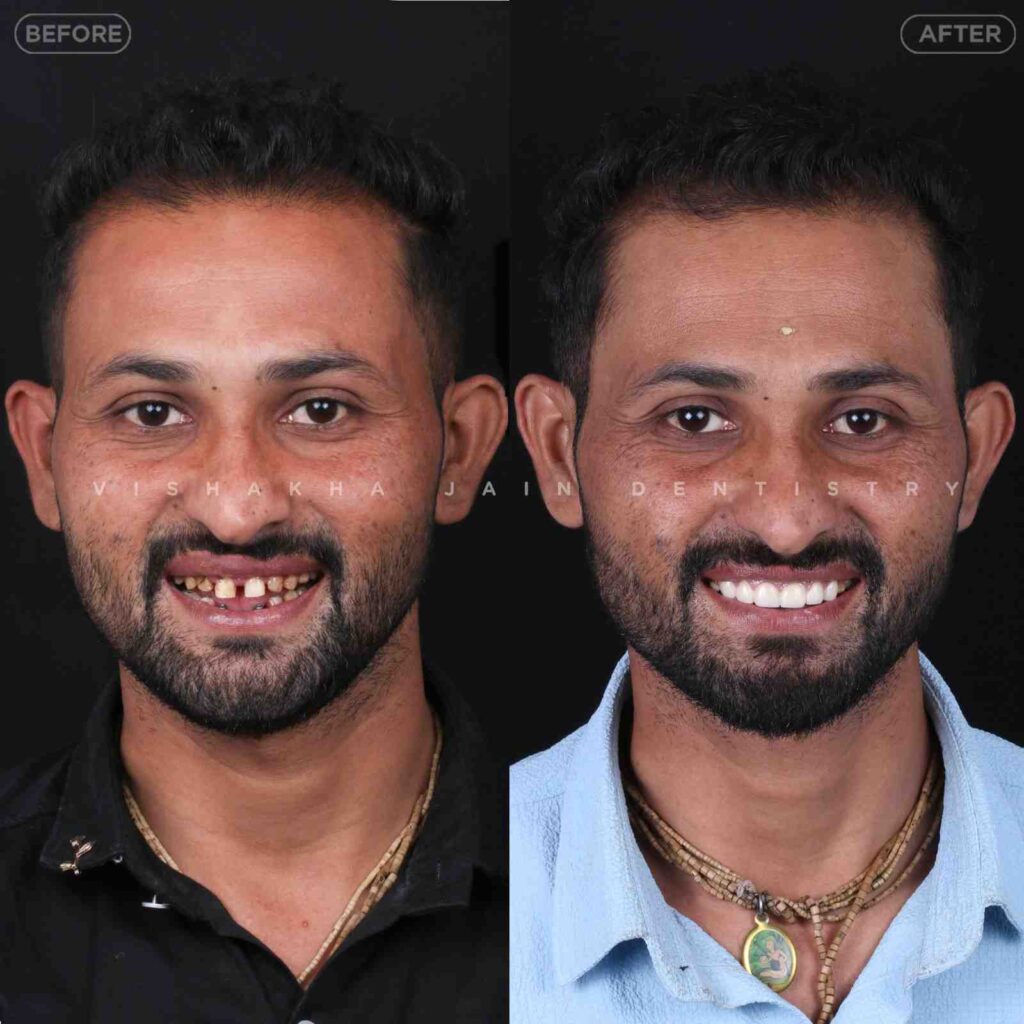 dentist near me, dental clinic near me, best dentist near me, nearby dentist, dental implants near me, teeth whitening near me, smile design near me, root canal near me, braces near me, aligners near me, cosmetic dentistry near me, gum treatment near me, pediatric dentist near me, oral care near me, affordable dentist near me