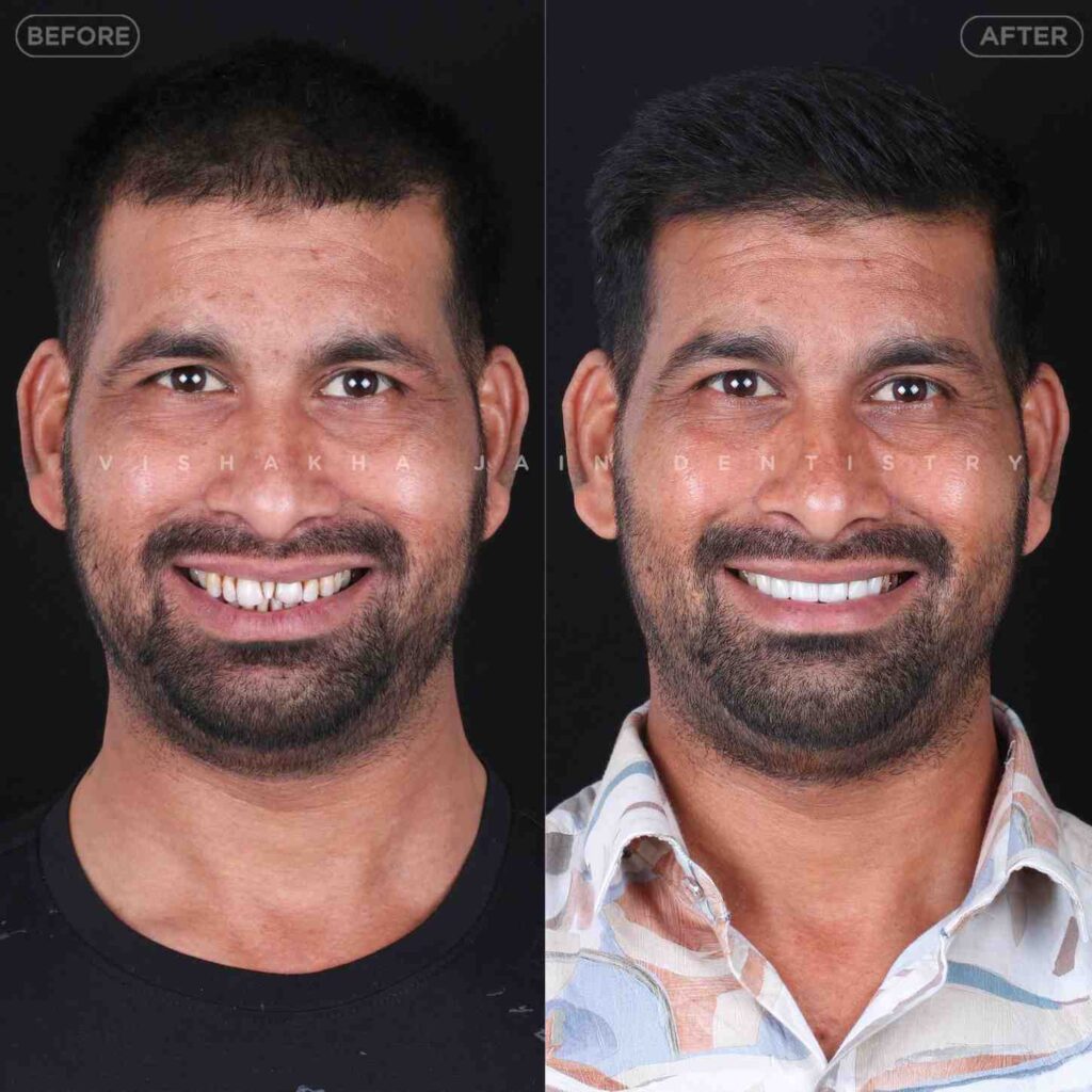 dentist near me, dental clinic near me, best dentist near me, nearby dentist, dental implants near me, teeth whitening near me, smile design near me, root canal near me, braces near me, aligners near me, cosmetic dentistry near me, gum treatment near me, pediatric dentist near me, oral care near me, affordable dentist near me