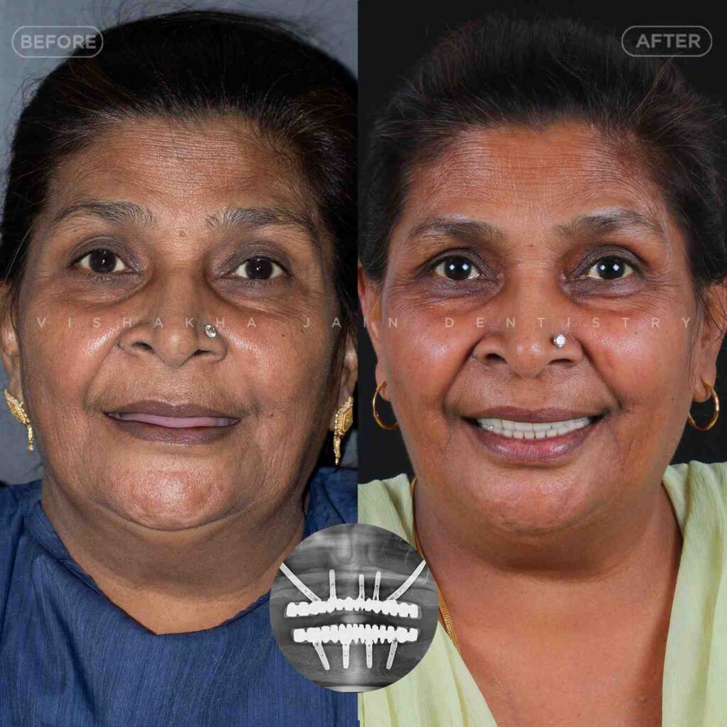 dentist near me, dental clinic near me, best dentist near me, nearby dentist, dental implants near me, teeth whitening near me, smile design near me, root canal near me, braces near me, aligners near me, cosmetic dentistry near me, gum treatment near me, pediatric dentist near me, oral care near me, affordable dentist near me