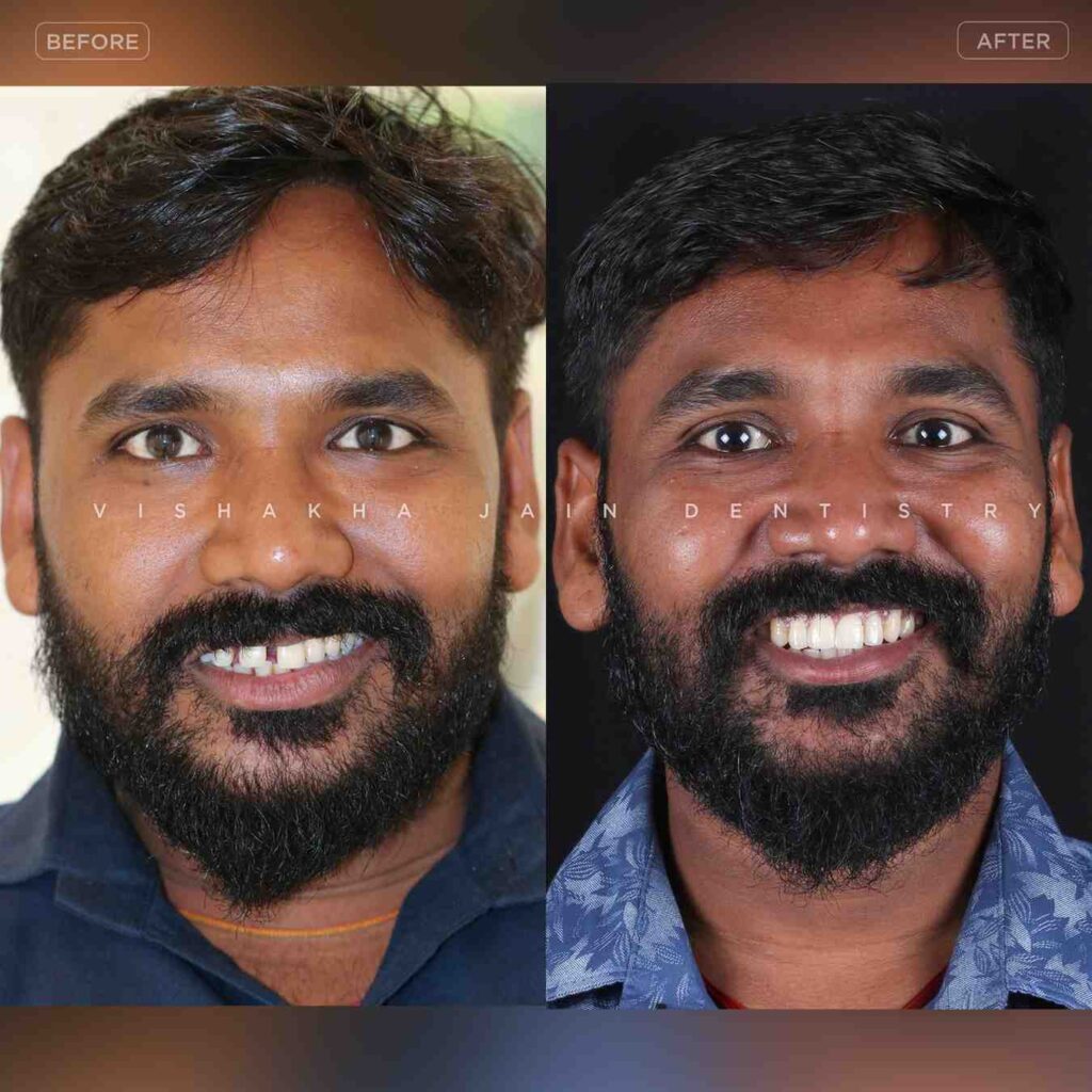 dentist near me, dental clinic near me, best dentist near me, nearby dentist, dental implants near me, teeth whitening near me, smile design near me, root canal near me, braces near me, aligners near me, cosmetic dentistry near me, gum treatment near me, pediatric dentist near me, oral care near me, affordable dentist near me