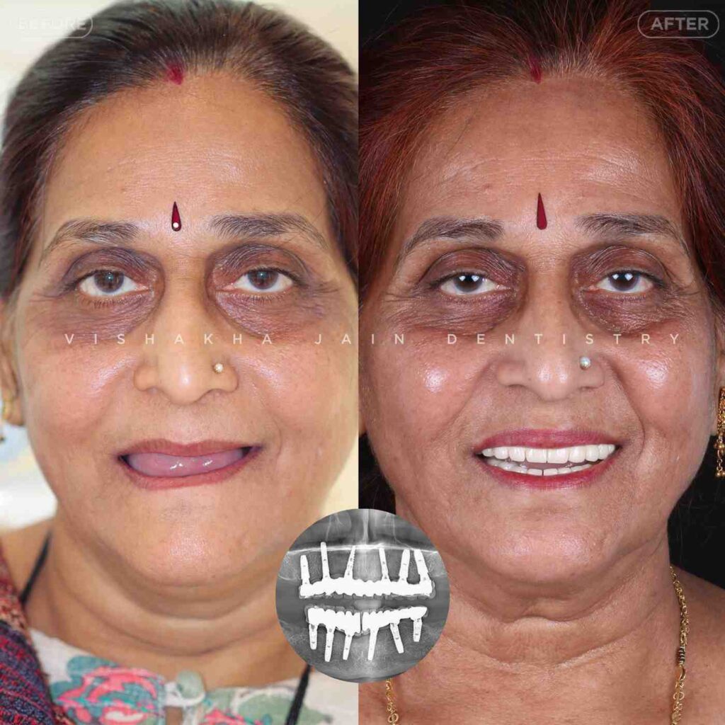 dentist near me, dental clinic near me, best dentist near me, nearby dentist, dental implants near me, teeth whitening near me, smile design near me, root canal near me, braces near me, aligners near me, cosmetic dentistry near me, gum treatment near me, pediatric dentist near me, oral care near me, affordable dentist near me