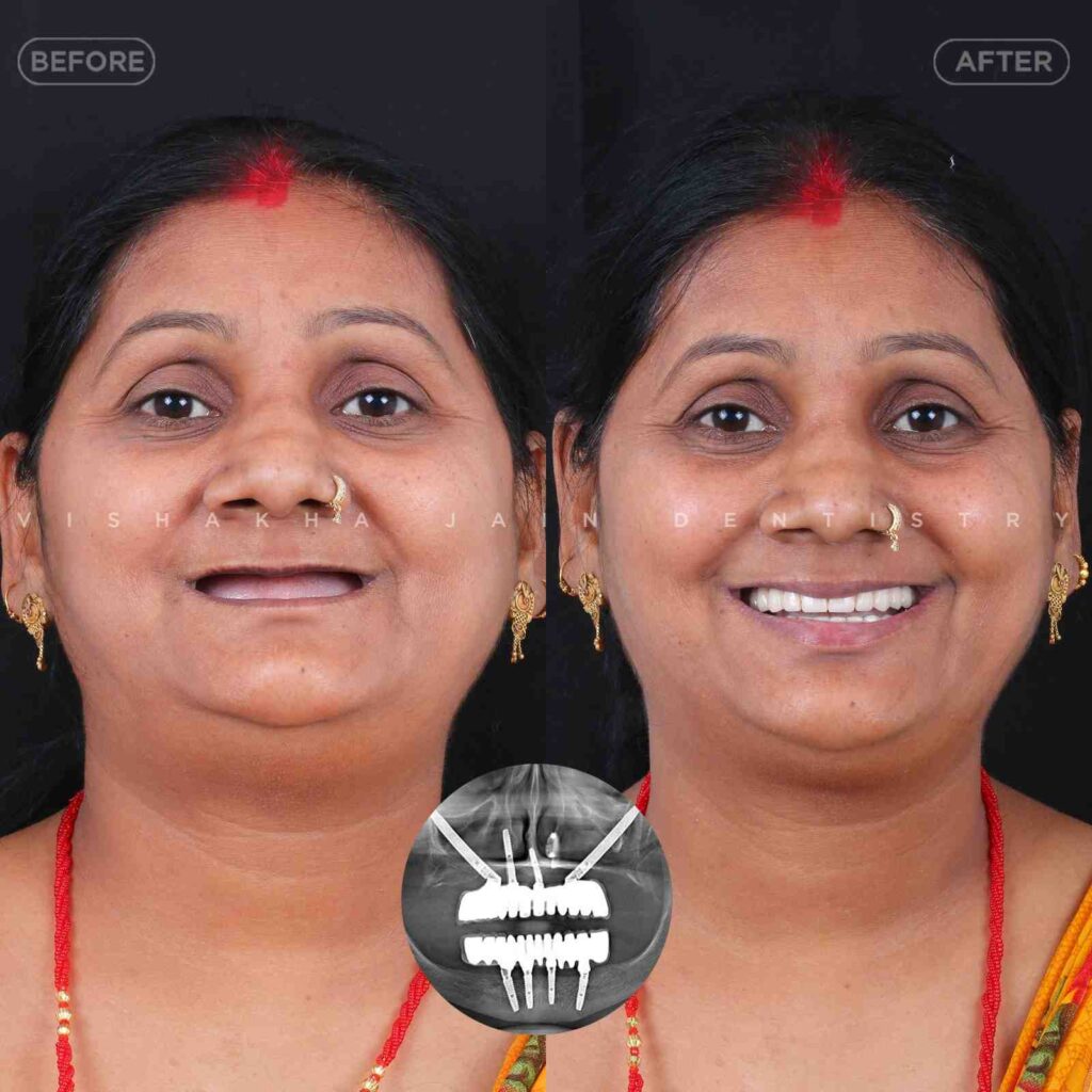 dentist near me, dental clinic near me, best dentist near me, nearby dentist, dental implants near me, teeth whitening near me, smile design near me, root canal near me, braces near me, aligners near me, cosmetic dentistry near me, gum treatment near me, pediatric dentist near me, oral care near me, affordable dentist near me
