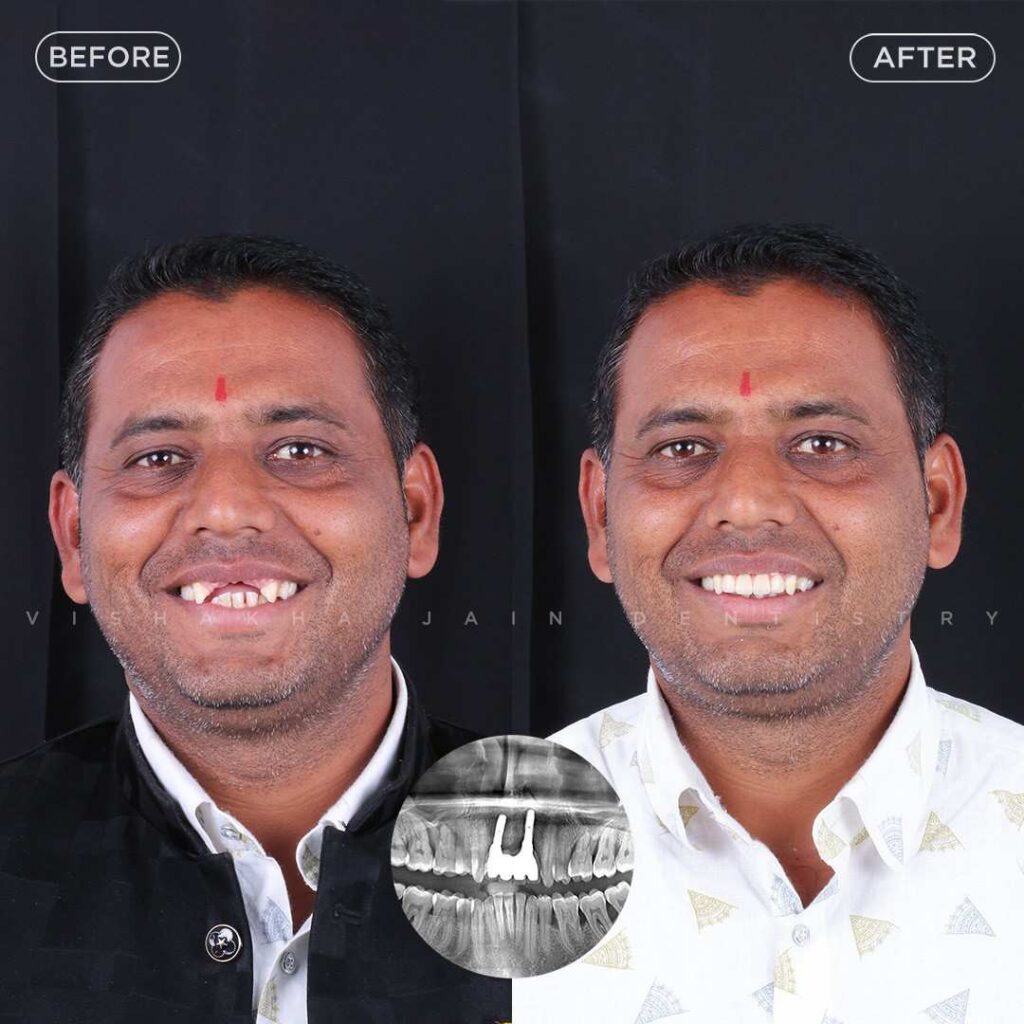 dentist near me, dental clinic near me, best dentist near me, nearby dentist, dental implants near me, teeth whitening near me, smile design near me, root canal near me, braces near me, aligners near me, cosmetic dentistry near me, gum treatment near me, pediatric dentist near me, oral care near me, affordable dentist near me