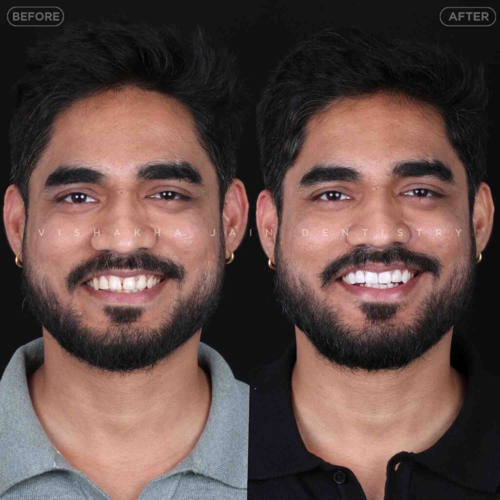 dentist near me, dental clinic near me, best dentist near me, nearby dentist, dental implants near me, teeth whitening near me, smile design near me, root canal near me, braces near me, aligners near me, cosmetic dentistry near me, gum treatment near me, pediatric dentist near me, oral care near me, affordable dentist near me