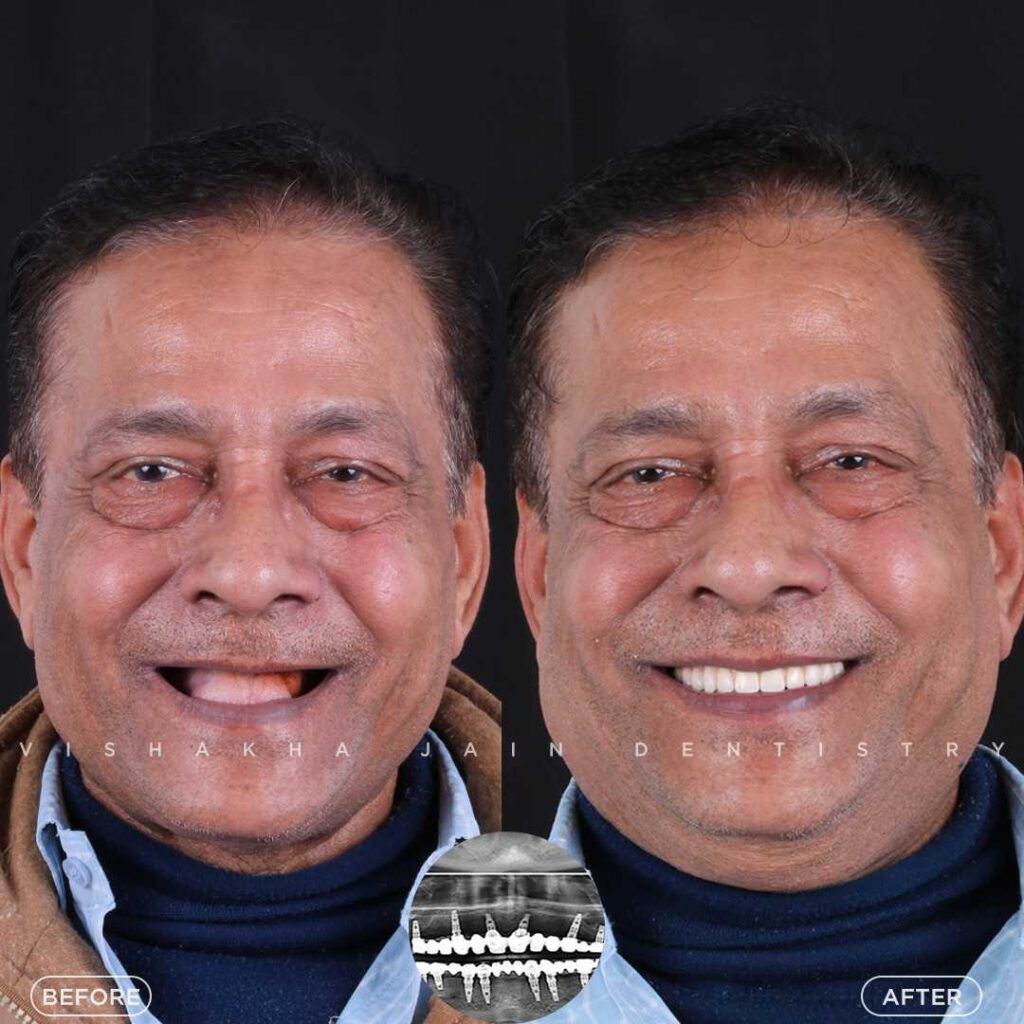 dentist near me, dental clinic near me, best dentist near me, nearby dentist, dental implants near me, teeth whitening near me, smile design near me, root canal near me, braces near me, aligners near me, cosmetic dentistry near me, gum treatment near me, pediatric dentist near me, oral care near me, affordable dentist near me