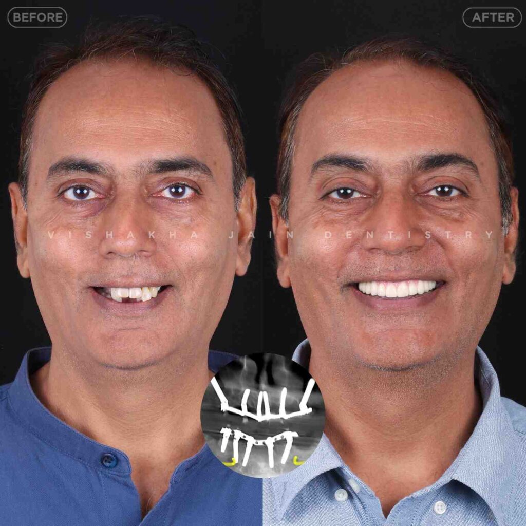 dentist near me, dental clinic near me, best dentist near me, nearby dentist, dental implants near me, teeth whitening near me, smile design near me, root canal near me, braces near me, aligners near me, cosmetic dentistry near me, gum treatment near me, pediatric dentist near me, oral care near me, affordable dentist near me