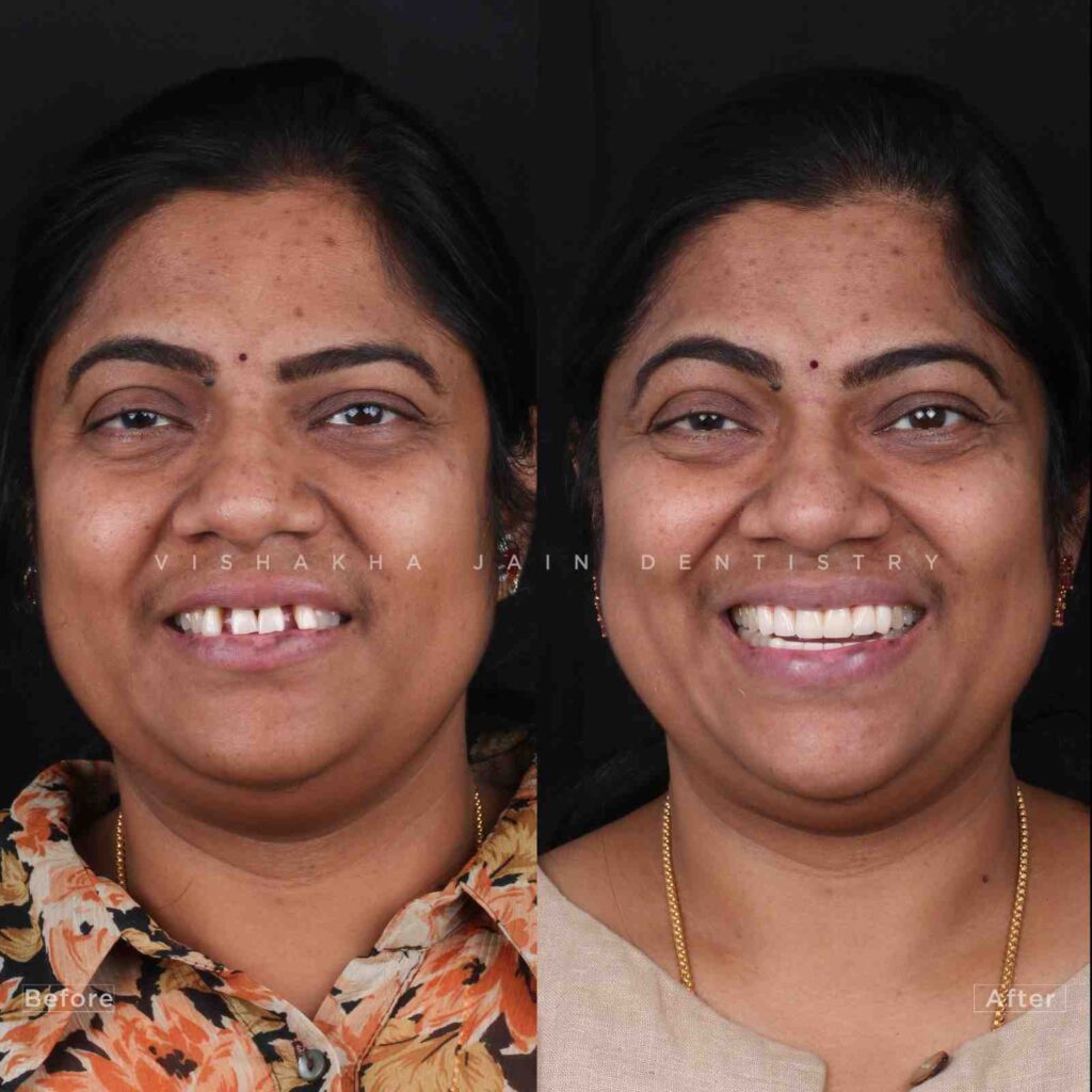 dentist near me, dental clinic near me, best dentist near me, nearby dentist, dental implants near me, teeth whitening near me, smile design near me, root canal near me, braces near me, aligners near me, cosmetic dentistry near me, gum treatment near me, pediatric dentist near me, oral care near me, affordable dentist near me