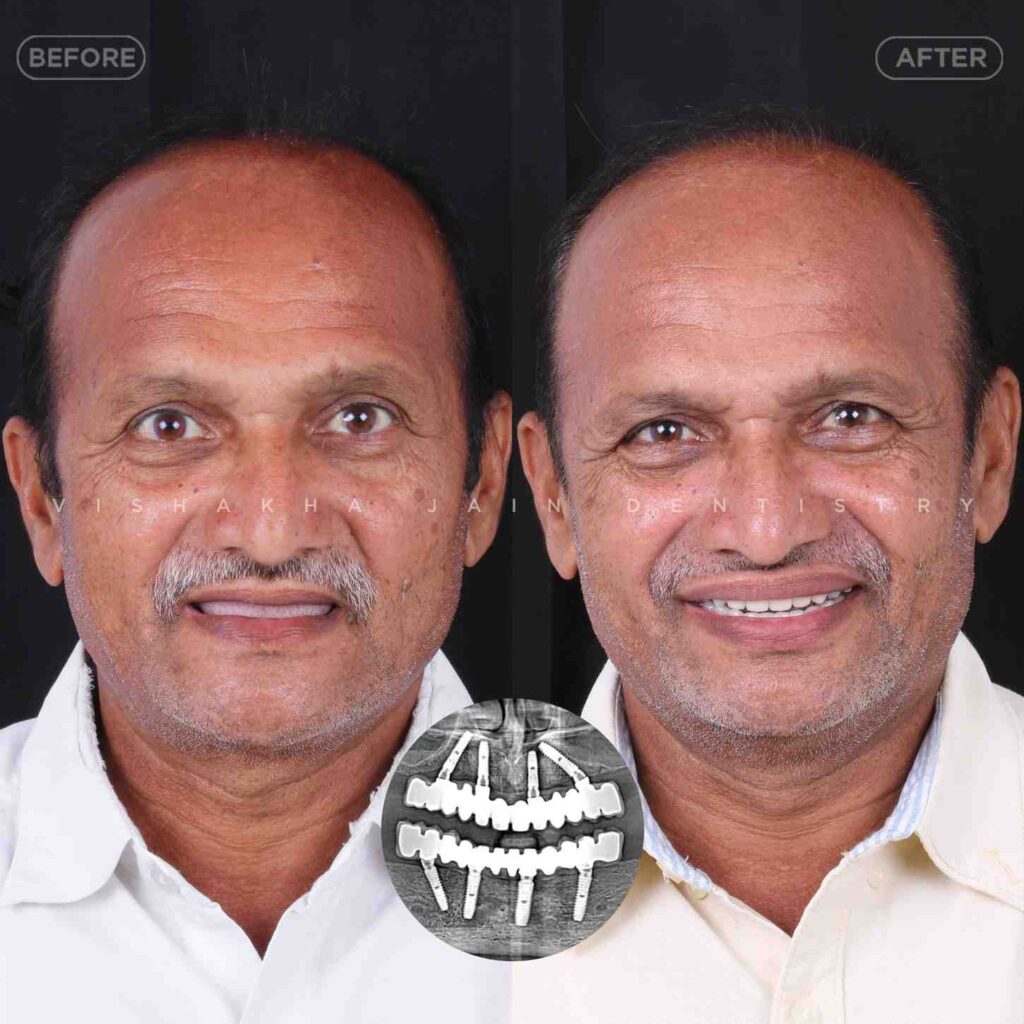 dentist near me, dental clinic near me, best dentist near me, nearby dentist, dental implants near me, teeth whitening near me, smile design near me, root canal near me, braces near me, aligners near me, cosmetic dentistry near me, gum treatment near me, pediatric dentist near me, oral care near me, affordable dentist near me