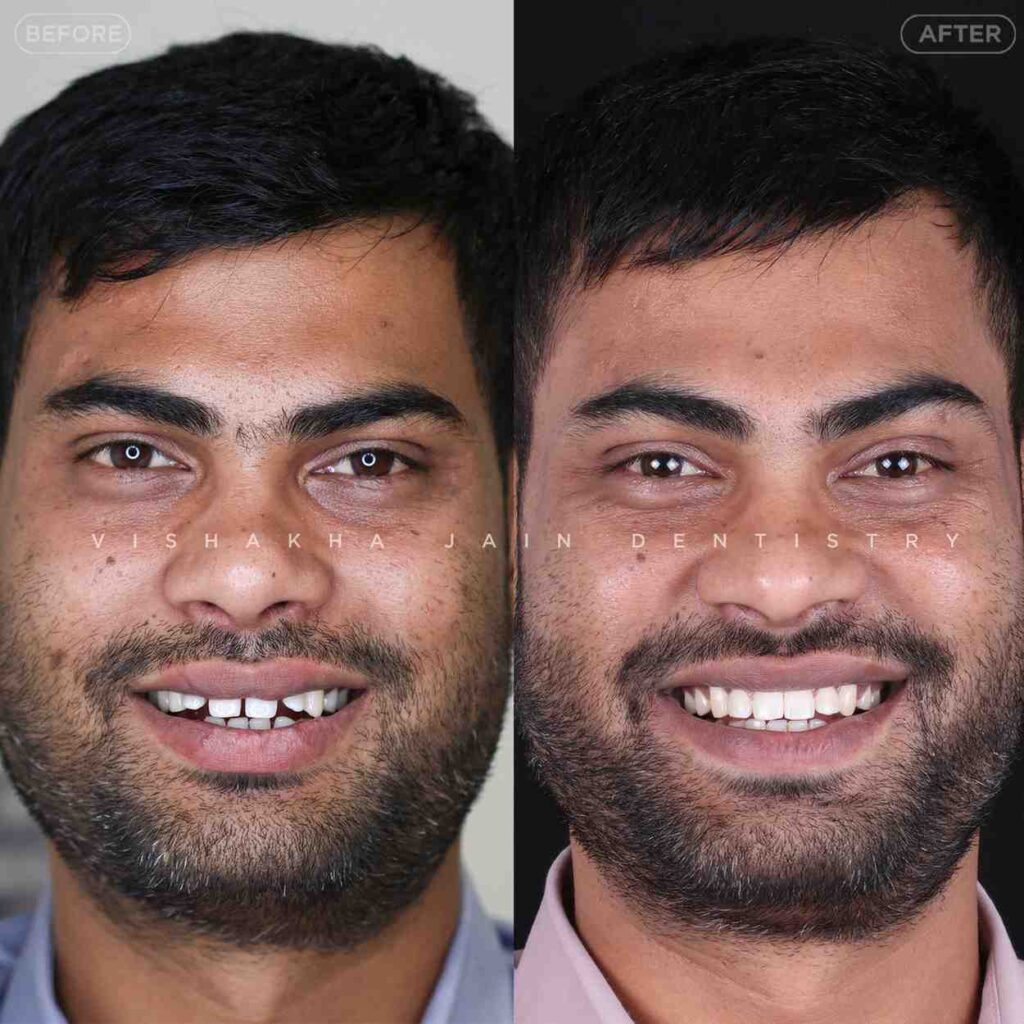 dentist near me, dental clinic near me, best dentist near me, nearby dentist, dental implants near me, teeth whitening near me, smile design near me, root canal near me, braces near me, aligners near me, cosmetic dentistry near me, gum treatment near me, pediatric dentist near me, oral care near me, affordable dentist near me
