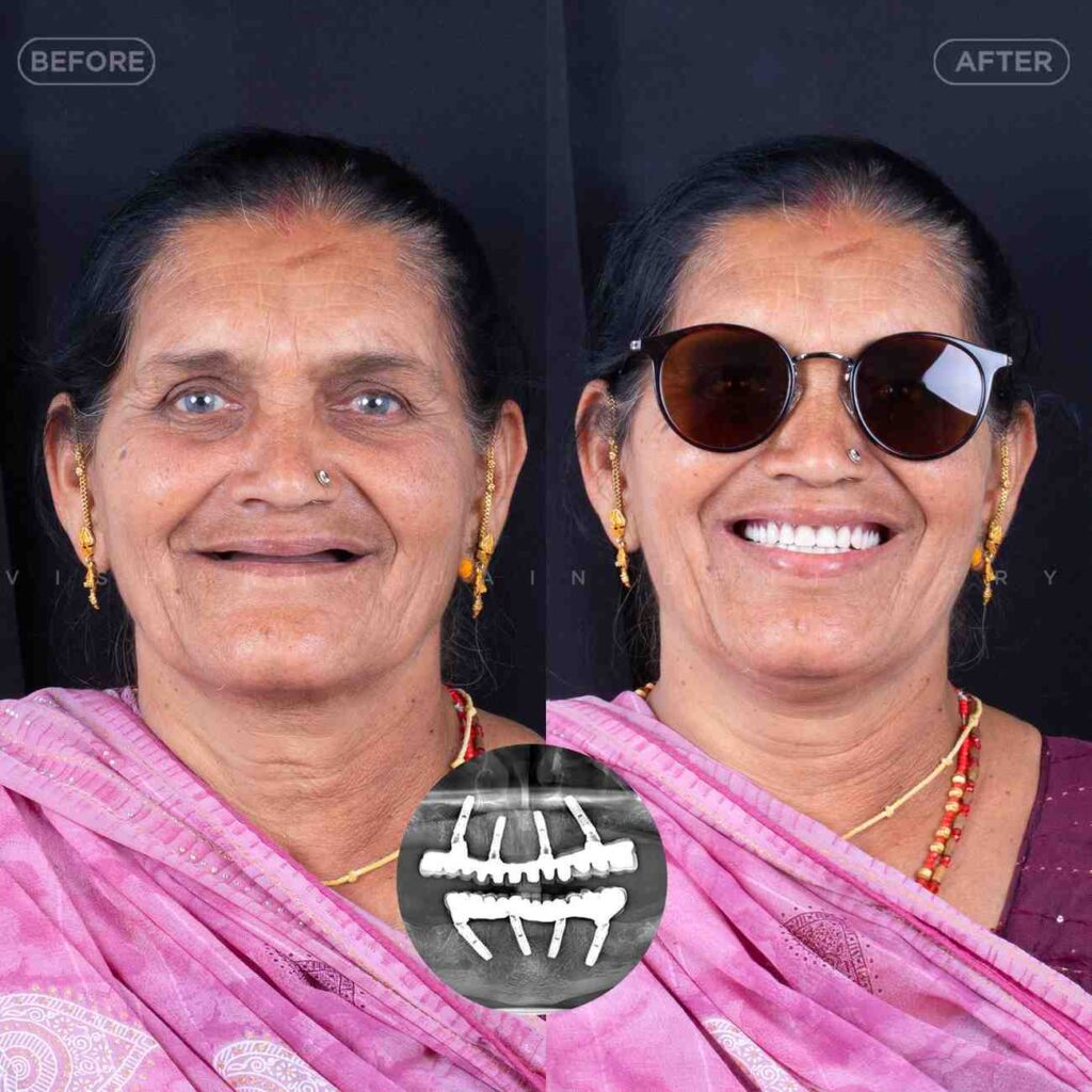 dentist near me, dental clinic near me, best dentist near me, nearby dentist, dental implants near me, teeth whitening near me, smile design near me, root canal near me, braces near me, aligners near me, cosmetic dentistry near me, gum treatment near me, pediatric dentist near me, oral care near me, affordable dentist near me