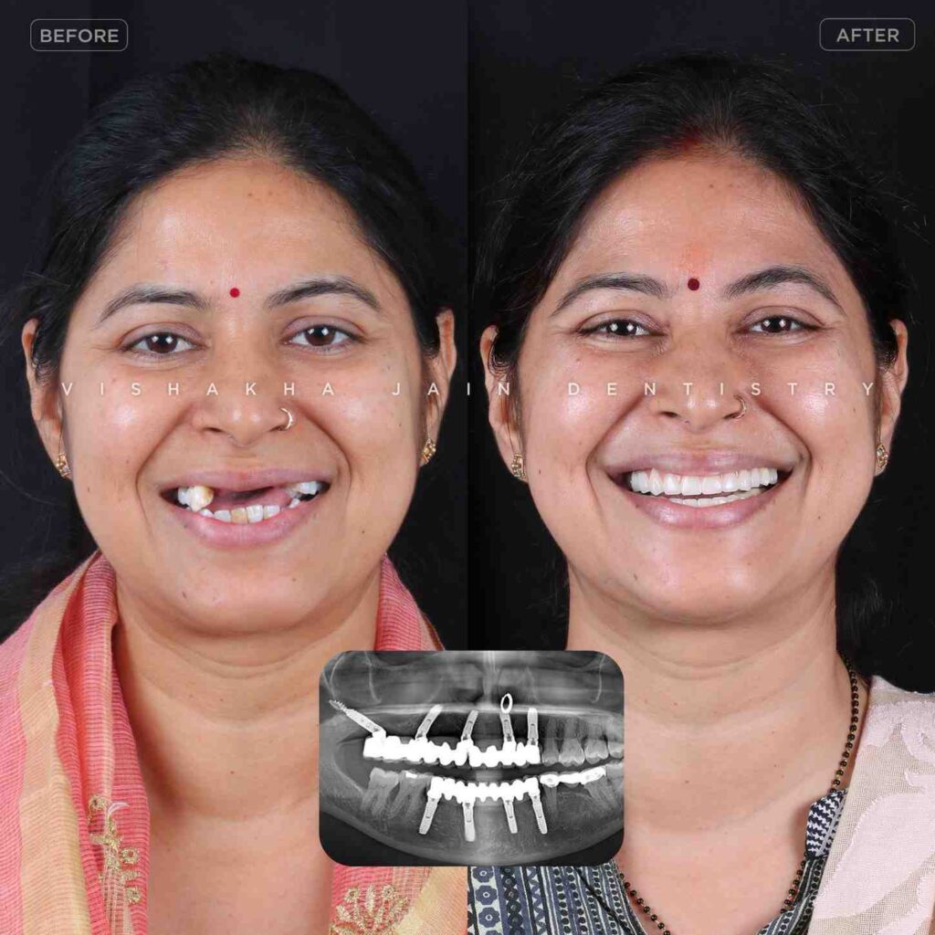 dentist near me, dental clinic near me, best dentist near me, nearby dentist, dental implants near me, teeth whitening near me, smile design near me, root canal near me, braces near me, aligners near me, cosmetic dentistry near me, gum treatment near me, pediatric dentist near me, oral care near me, affordable dentist near me
