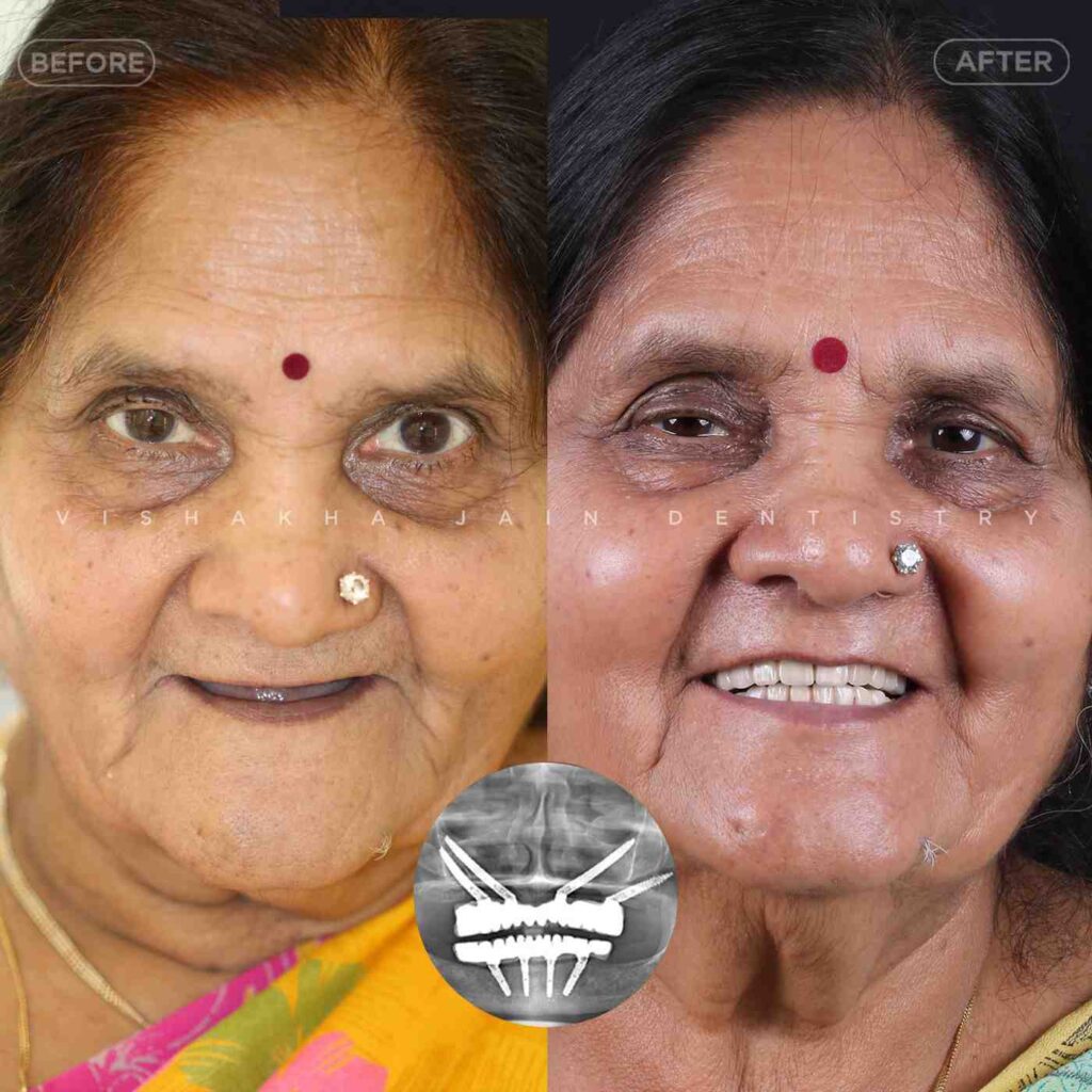 dentist near me, dental clinic near me, best dentist near me, nearby dentist, dental implants near me, teeth whitening near me, smile design near me, root canal near me, braces near me, aligners near me, cosmetic dentistry near me, gum treatment near me, pediatric dentist near me, oral care near me, affordable dentist near me