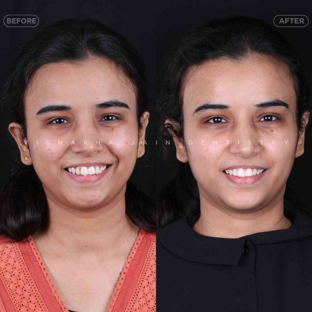 dentist near me, dental clinic near me, best dentist near me, nearby dentist, dental implants near me, teeth whitening near me, smile design near me, root canal near me, braces near me, aligners near me, cosmetic dentistry near me, gum treatment near me, pediatric dentist near me, oral care near me, affordable dentist near me
