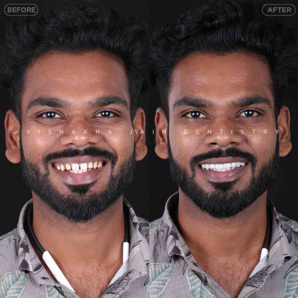 dentist near me, dental clinic near me, best dentist near me, nearby dentist, dental implants near me, teeth whitening near me, smile design near me, root canal near me, braces near me, aligners near me, cosmetic dentistry near me, gum treatment near me, pediatric dentist near me, oral care near me, affordable dentist near me
