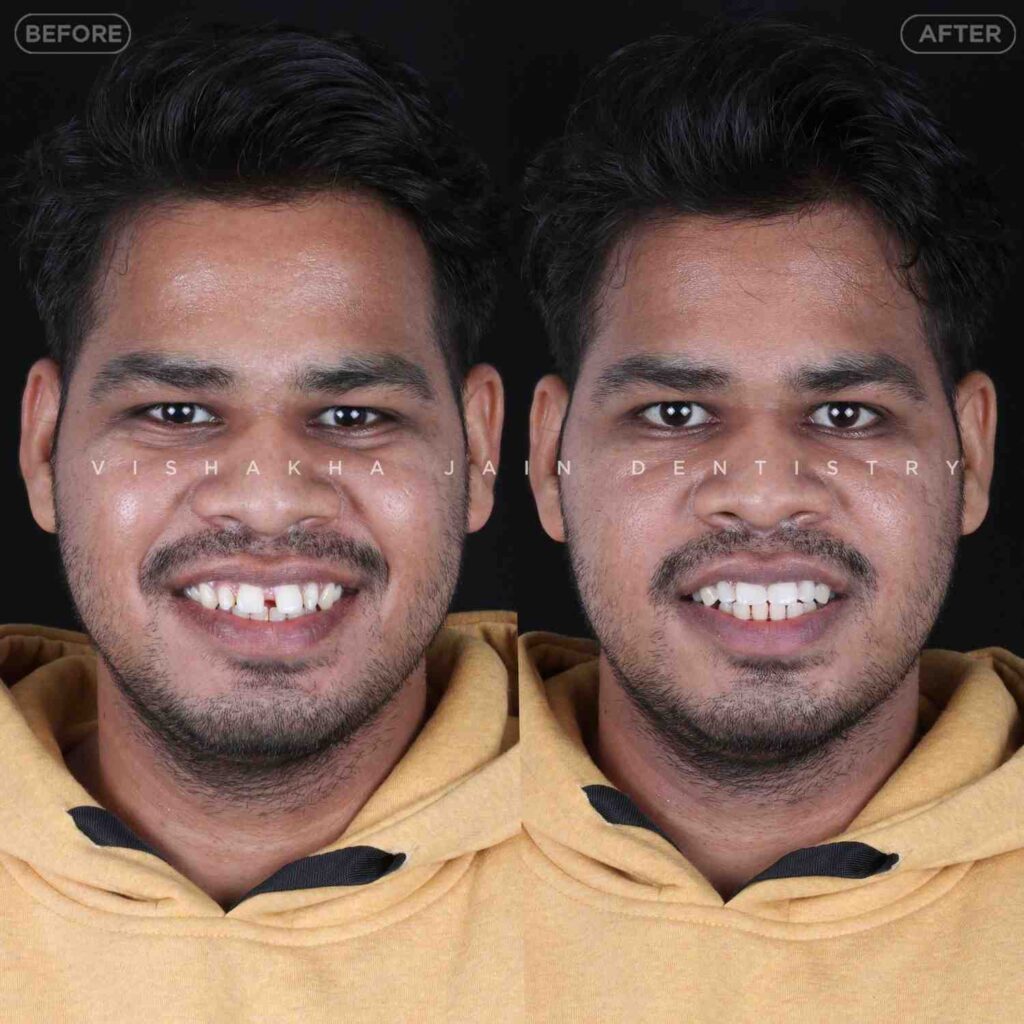 dentist near me, dental clinic near me, best dentist near me, nearby dentist, dental implants near me, teeth whitening near me, smile design near me, root canal near me, braces near me, aligners near me, cosmetic dentistry near me, gum treatment near me, pediatric dentist near me, oral care near me, affordable dentist near me