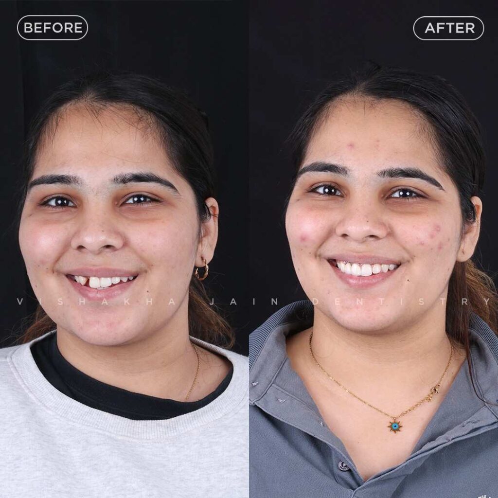 dentist near me, dental clinic near me, best dentist near me, nearby dentist, dental implants near me, teeth whitening near me, smile design near me, root canal near me, braces near me, aligners near me, cosmetic dentistry near me, gum treatment near me, pediatric dentist near me, oral care near me, affordable dentist near me