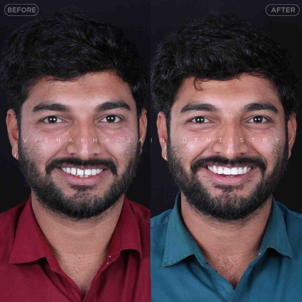 dentist near me, dental clinic near me, best dentist near me, nearby dentist, dental implants near me, teeth whitening near me, smile design near me, root canal near me, braces near me, aligners near me, cosmetic dentistry near me, gum treatment near me, pediatric dentist near me, oral care near me, affordable dentist near me