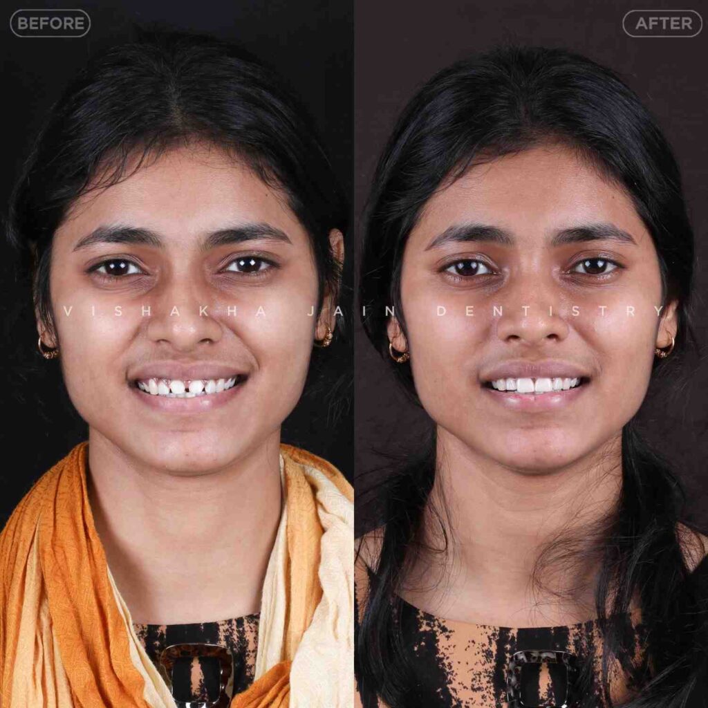 dentist near me, dental clinic near me, best dentist near me, nearby dentist, dental implants near me, teeth whitening near me, smile design near me, root canal near me, braces near me, aligners near me, cosmetic dentistry near me, gum treatment near me, pediatric dentist near me, oral care near me, affordable dentist near me