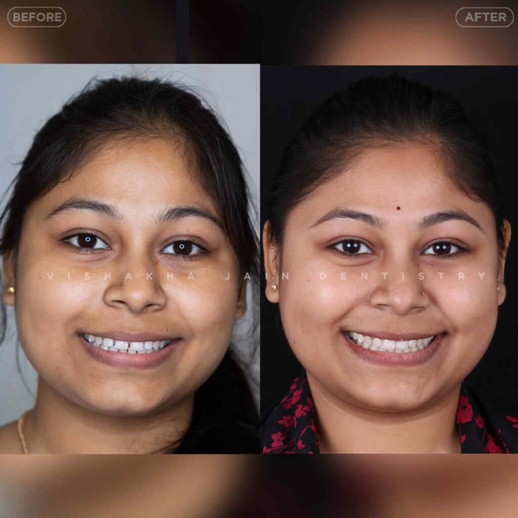 dentist near me, dental clinic near me, best dentist near me, nearby dentist, dental implants near me, teeth whitening near me, smile design near me, root canal near me, braces near me, aligners near me, cosmetic dentistry near me, gum treatment near me, pediatric dentist near me, oral care near me, affordable dentist near me