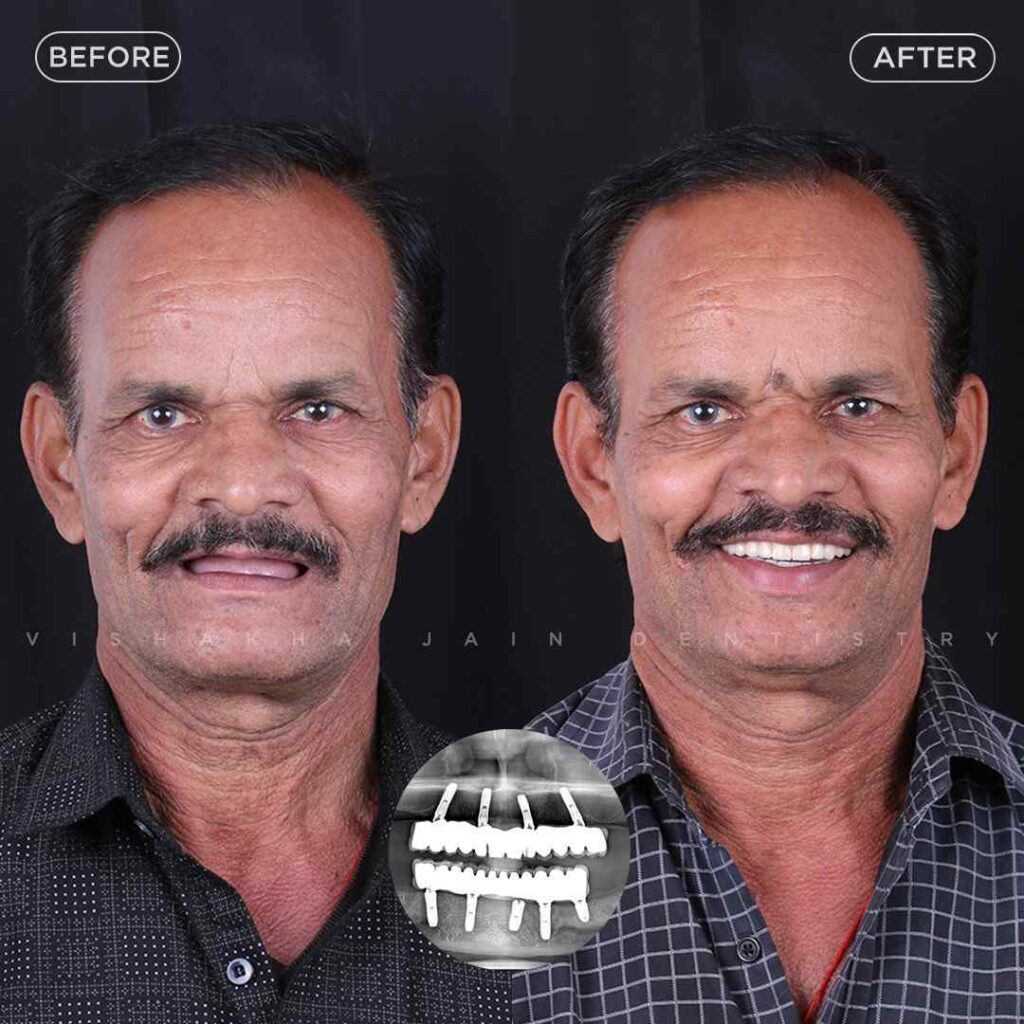 dentist near me, dental clinic near me, best dentist near me, nearby dentist, dental implants near me, teeth whitening near me, smile design near me, root canal near me, braces near me, aligners near me, cosmetic dentistry near me, gum treatment near me, pediatric dentist near me, oral care near me, affordable dentist near me