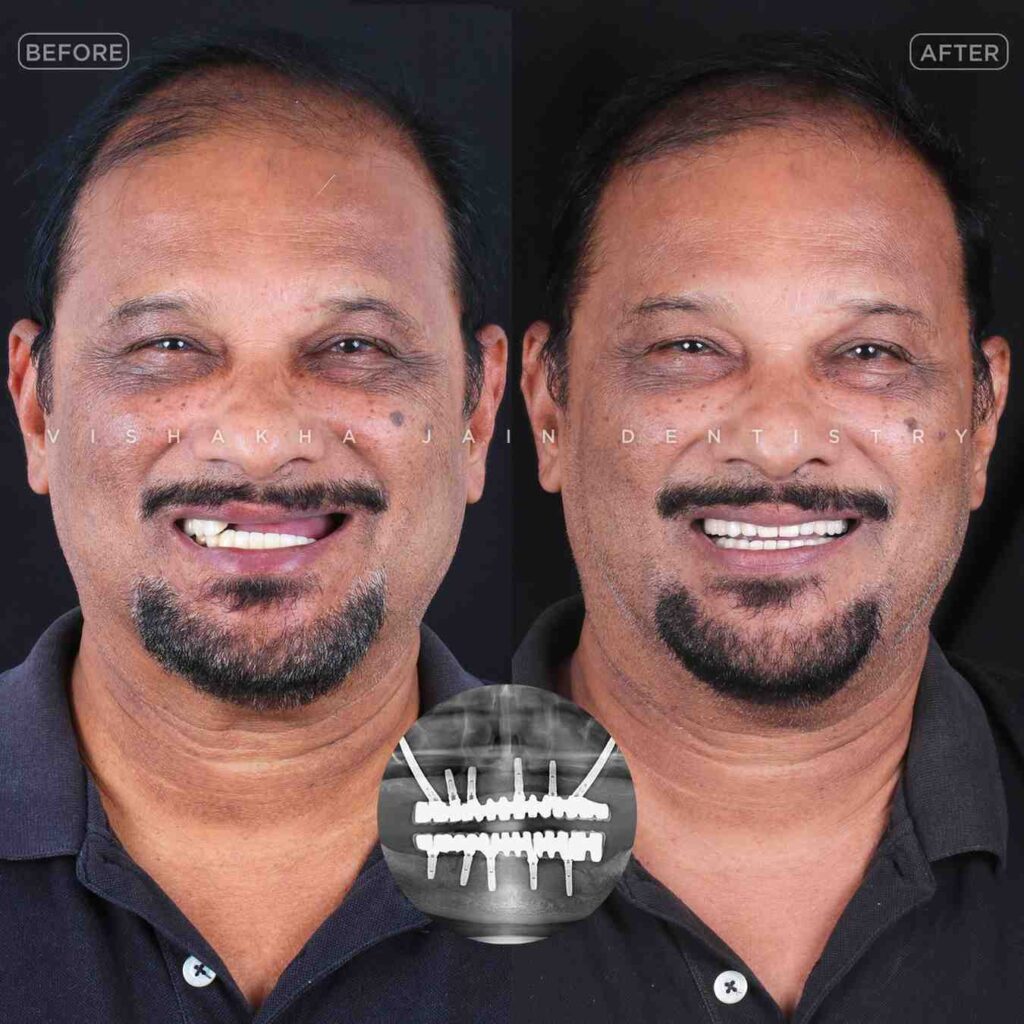 dentist near me, dental clinic near me, best dentist near me, nearby dentist, dental implants near me, teeth whitening near me, smile design near me, root canal near me, braces near me, aligners near me, cosmetic dentistry near me, gum treatment near me, pediatric dentist near me, oral care near me, affordable dentist near me