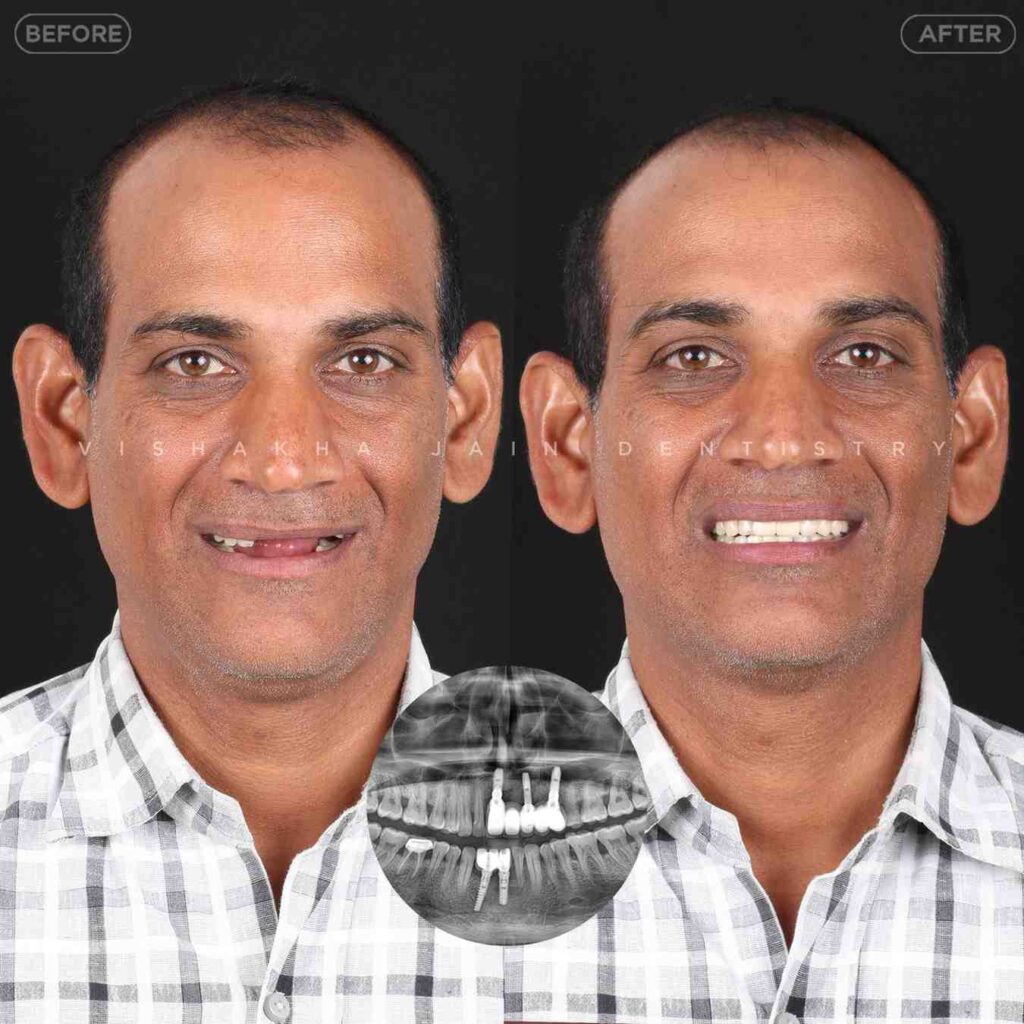 dentist near me, dental clinic near me, best dentist near me, nearby dentist, dental implants near me, teeth whitening near me, smile design near me, root canal near me, braces near me, aligners near me, cosmetic dentistry near me, gum treatment near me, pediatric dentist near me, oral care near me, affordable dentist near me
