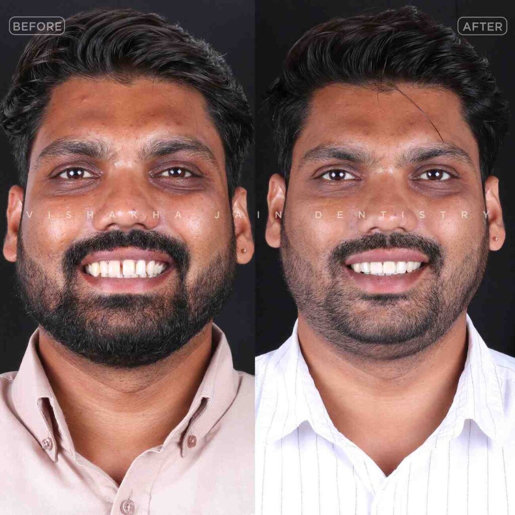 dentist near me, dental clinic near me, best dentist near me, nearby dentist, dental implants near me, teeth whitening near me, smile design near me, root canal near me, braces near me, aligners near me, cosmetic dentistry near me, gum treatment near me, pediatric dentist near me, oral care near me, affordable dentist near me