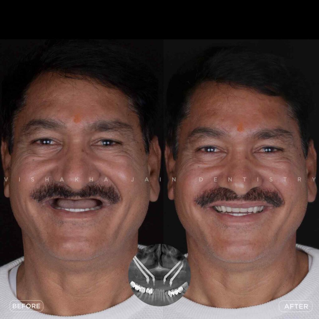 dentist near me, dental clinic near me, best dentist near me, nearby dentist, dental implants near me, teeth whitening near me, smile design near me, root canal near me, braces near me, aligners near me, cosmetic dentistry near me, gum treatment near me, pediatric dentist near me, oral care near me, affordable dentist near me