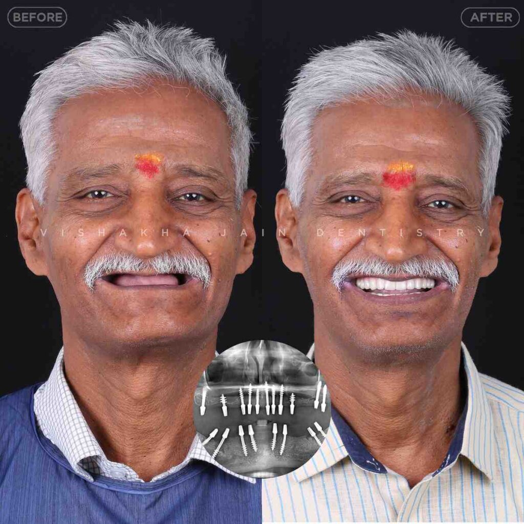 dentist near me, dental clinic near me, best dentist near me, nearby dentist, dental implants near me, teeth whitening near me, smile design near me, root canal near me, braces near me, aligners near me, cosmetic dentistry near me, gum treatment near me, pediatric dentist near me, oral care near me, affordable dentist near me