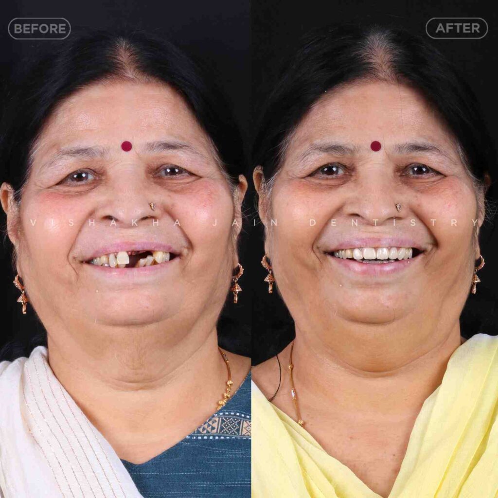 dentist near me, dental clinic near me, best dentist near me, nearby dentist, dental implants near me, teeth whitening near me, smile design near me, root canal near me, braces near me, aligners near me, cosmetic dentistry near me, gum treatment near me, pediatric dentist near me, oral care near me, affordable dentist near me