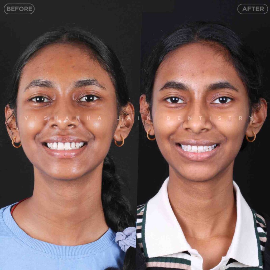 dentist near me, dental clinic near me, best dentist near me, nearby dentist, dental implants near me, teeth whitening near me, smile design near me, root canal near me, braces near me, aligners near me, cosmetic dentistry near me, gum treatment near me, pediatric dentist near me, oral care near me, affordable dentist near me