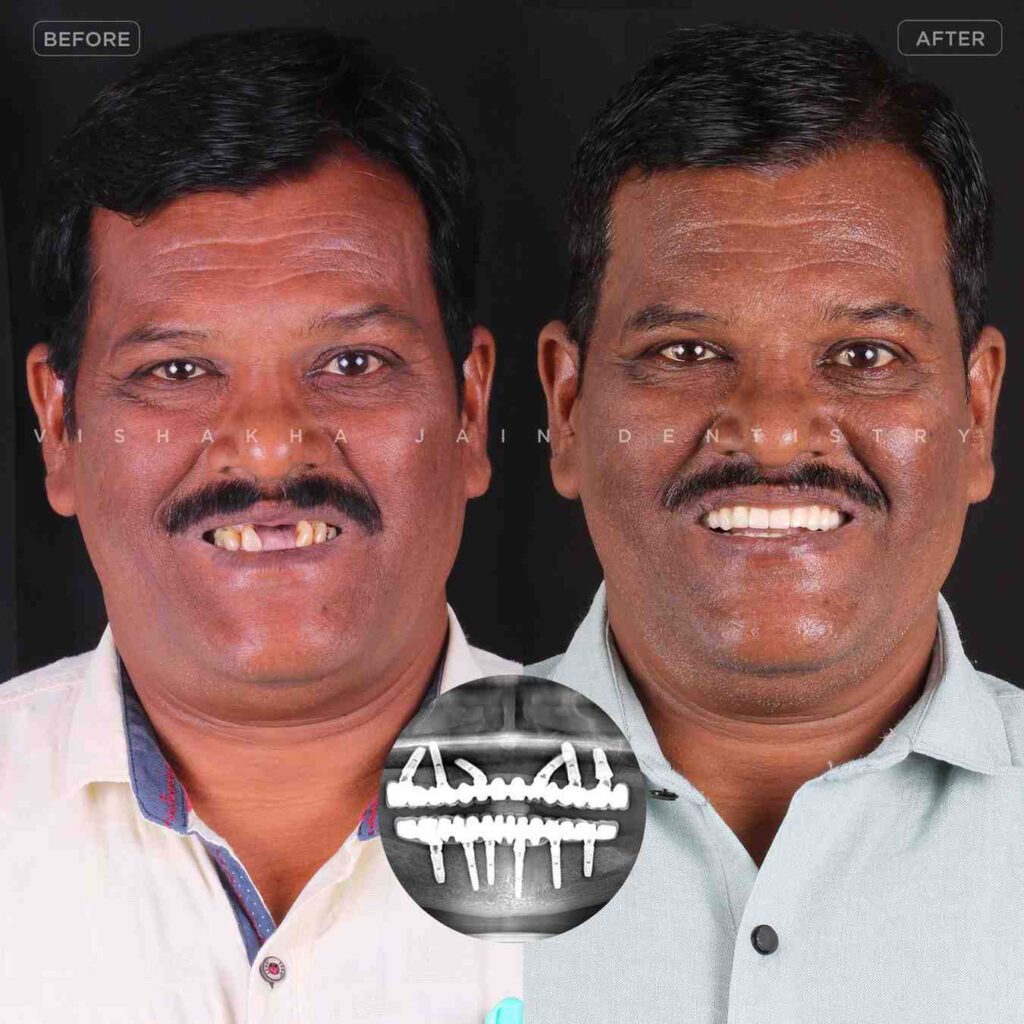 dentist near me, dental clinic near me, best dentist near me, nearby dentist, dental implants near me, teeth whitening near me, smile design near me, root canal near me, braces near me, aligners near me, cosmetic dentistry near me, gum treatment near me, pediatric dentist near me, oral care near me, affordable dentist near me