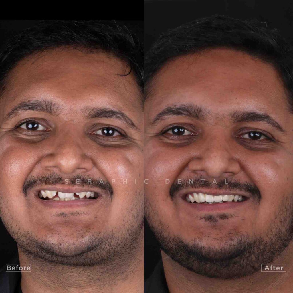 dentist near me, dental clinic near me, best dentist near me, nearby dentist, dental implants near me, teeth whitening near me, smile design near me, root canal near me, braces near me, aligners near me, cosmetic dentistry near me, gum treatment near me, pediatric dentist near me, oral care near me, affordable dentist near me