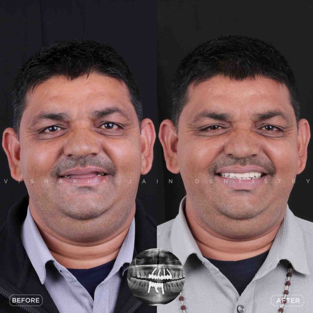 dentist near me, dental clinic near me, best dentist near me, nearby dentist, dental implants near me, teeth whitening near me, smile design near me, root canal near me, braces near me, aligners near me, cosmetic dentistry near me, gum treatment near me, pediatric dentist near me, oral care near me, affordable dentist near me
