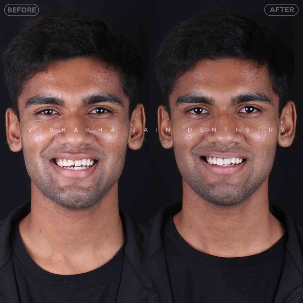 dentist near me, dental clinic near me, best dentist near me, nearby dentist, dental implants near me, teeth whitening near me, smile design near me, root canal near me, braces near me, aligners near me, cosmetic dentistry near me, gum treatment near me, pediatric dentist near me, oral care near me, affordable dentist near me