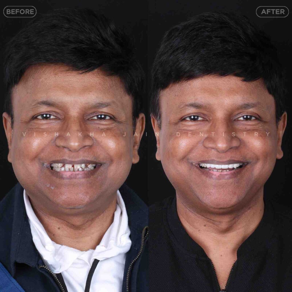 dentist near me, dental clinic near me, best dentist near me, nearby dentist, dental implants near me, teeth whitening near me, smile design near me, root canal near me, braces near me, aligners near me, cosmetic dentistry near me, gum treatment near me, pediatric dentist near me, oral care near me, affordable dentist near me